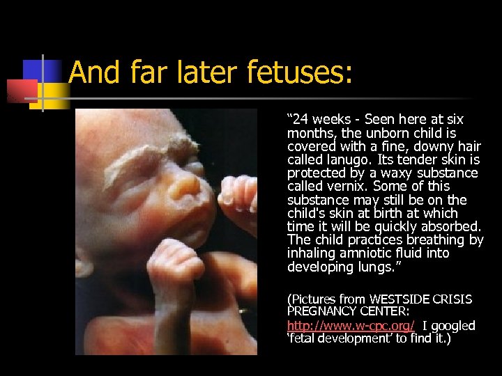 And far later fetuses: “ 24 weeks - Seen here at six months, the