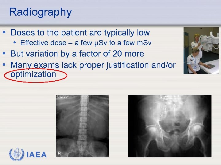 Radiography • Doses to the patient are typically low • Effective dose – a