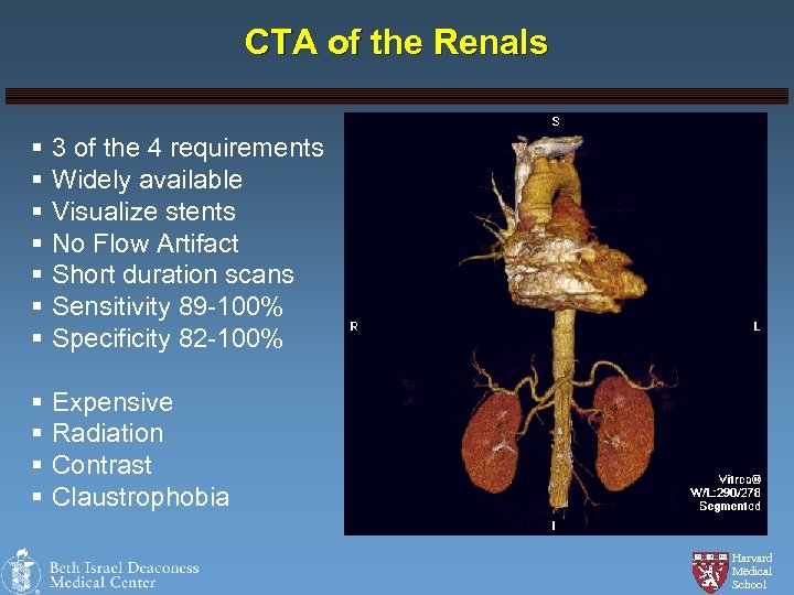 CTA of the Renals § § § § 3 of the 4 requirements Widely