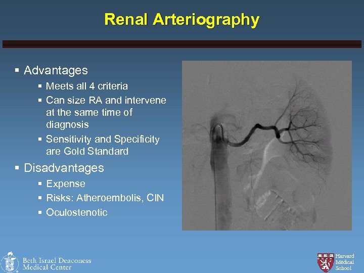 Renal Arteriography § Advantages § Meets all 4 criteria § Can size RA and