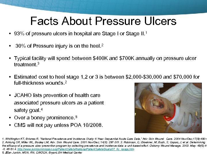 Facts About Pressure Ulcers • 93% of pressure ulcers in hospital are Stage I