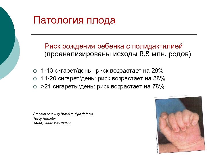 Патология плода Риск рождения ребенка с полидактилией (проанализированы исходы 6, 8 млн. родов) 1