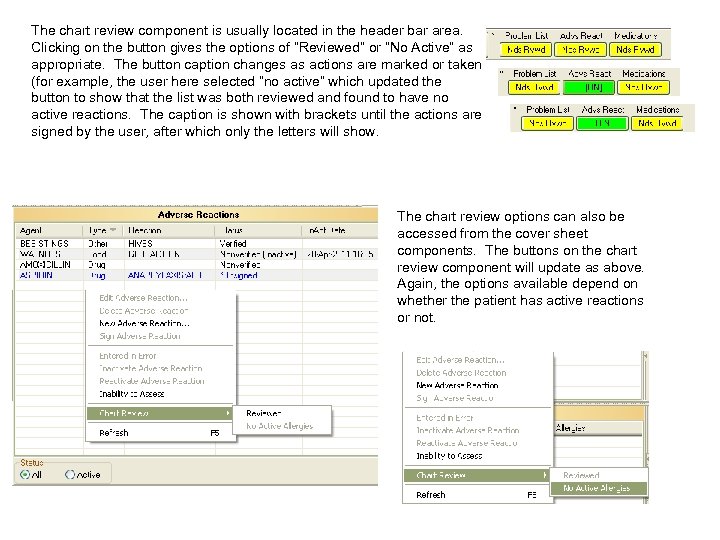 The chart review component is usually located in the header bar area. Clicking on