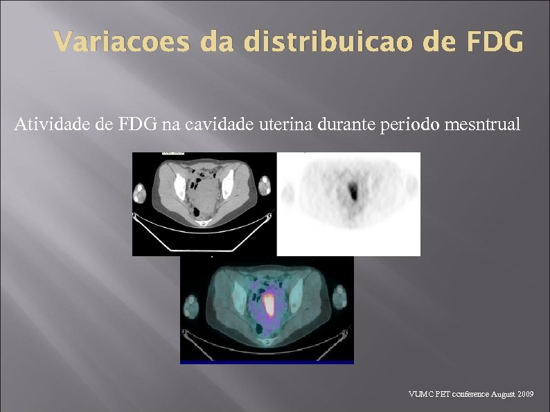 Variacoes da distribuicao de FDG Atividade de FDG na cavidade uterina durante periodo mesntrual