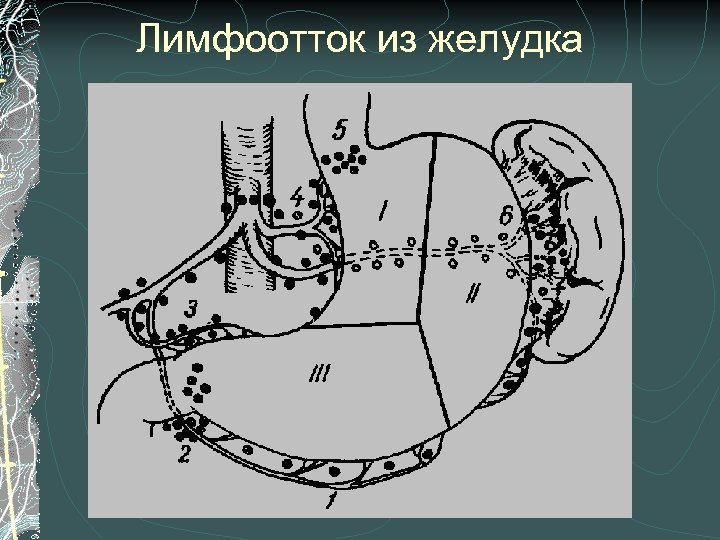 Лимфоотток из желудка 