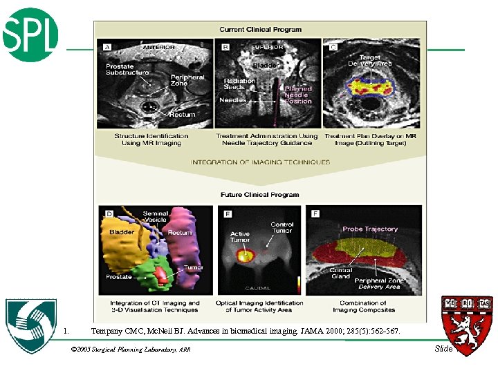 1. Tempany CMC, Mc. Neil BJ. Advances in biomedical imaging. JAMA 2000; 285(5): 562