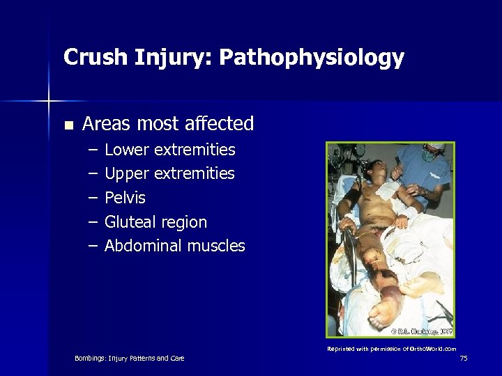 Crush Injury: Pathophysiology n Areas most affected – – – Lower extremities Upper extremities