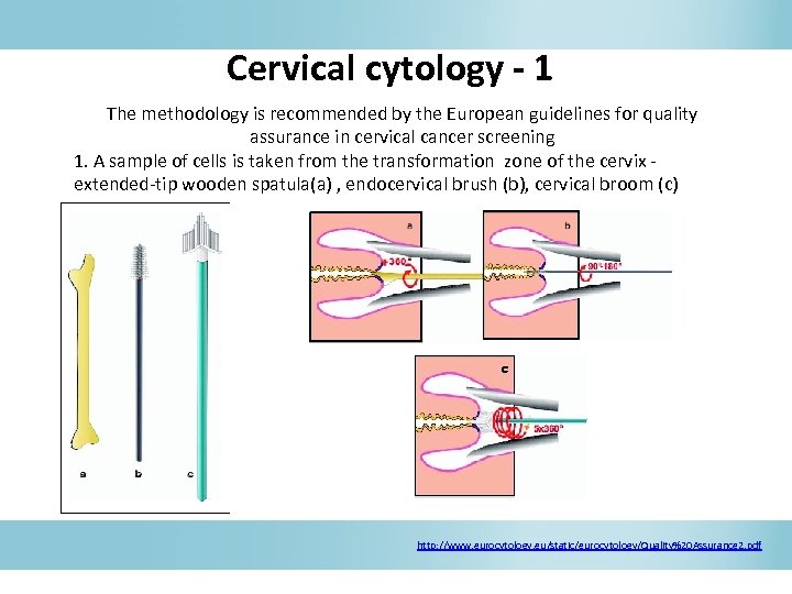 Cervical cytology - 1 The methodology is recommended by the European guidelines for quality
