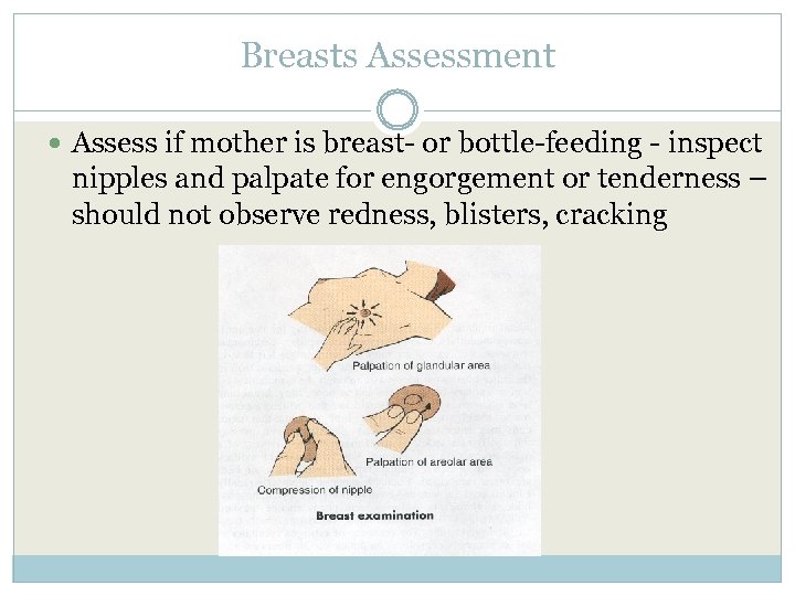 Breasts Assessment Assess if mother is breast- or bottle-feeding - inspect nipples and palpate