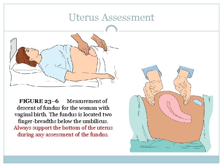 Uterus Assessment FIGURE 23– 6 Measurement of descent of fundus for the woman with
