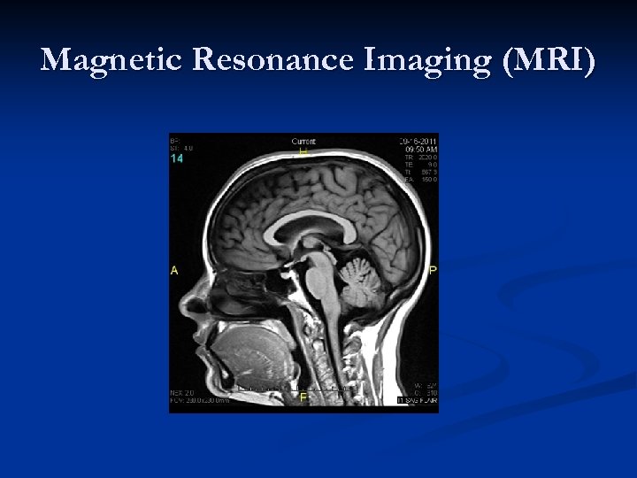 Magnetic Resonance Imaging (MRI) 