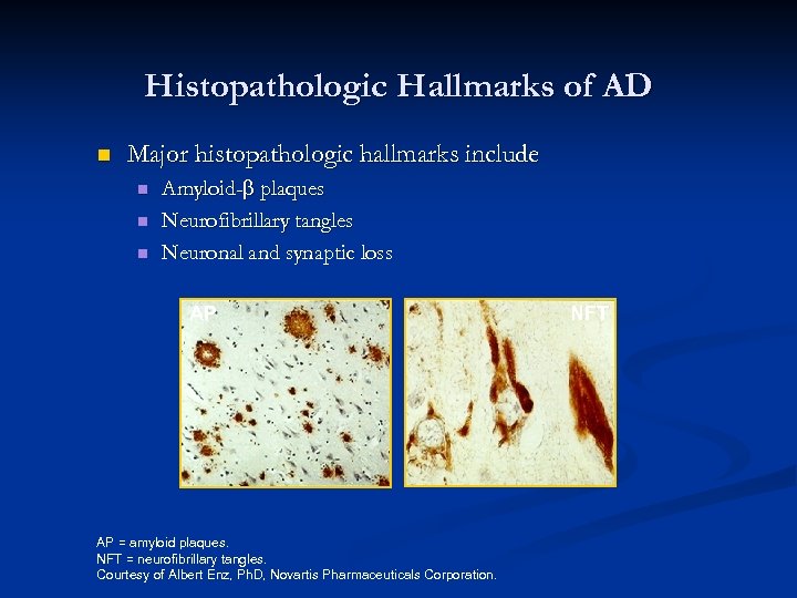 Histopathologic Hallmarks of AD n Major histopathologic hallmarks include n n n Amyloid- plaques