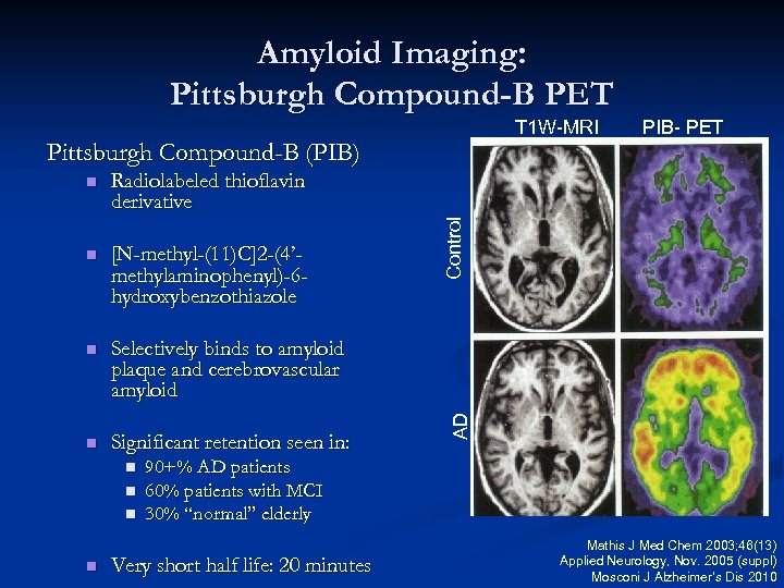 Amyloid Imaging: Pittsburgh Compound-B PET T 1 W-MRI Pittsburgh Compound-B (PIB) n [N-methyl-(11)C]2 -(4’methylaminophenyl)-6