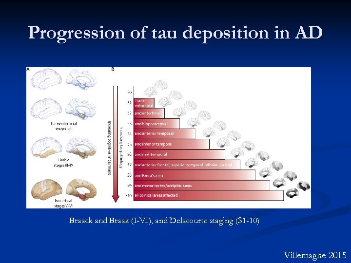 Progression of tau deposition in AD Braack and Braak (I-VI), and Delacourte staging (S