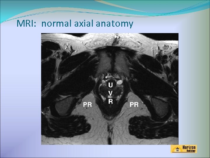 MRI: normal axial anatomy 