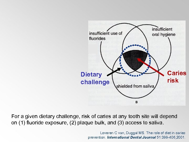 Dietary challenge Caries risk For a given dietary challenge, risk of caries at any