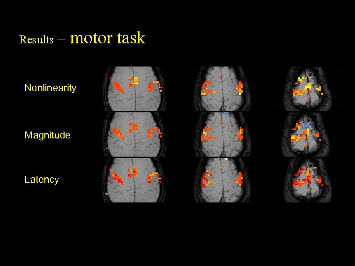 Results – motor task Nonlinearity Magnitude Latency 