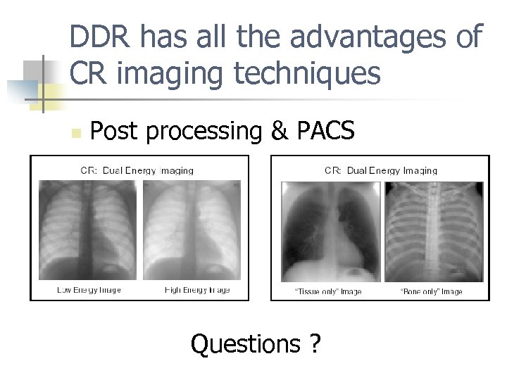 DDR has all the advantages of CR imaging techniques n Post processing & PACS