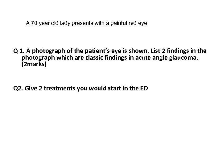A 70 year old lady presents with a painful red eye Q 1. A