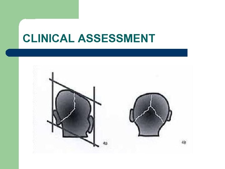 CLINICAL ASSESSMENT 