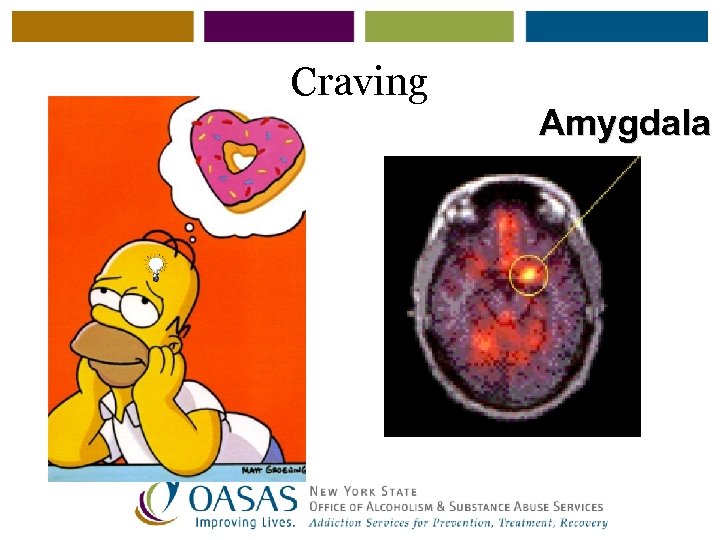 Craving Amygdala 