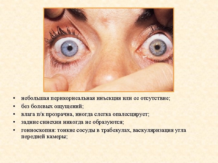  • • • небольшая перикорнеальная инъекция или ее отсутствие; без болевых ощущений; влага