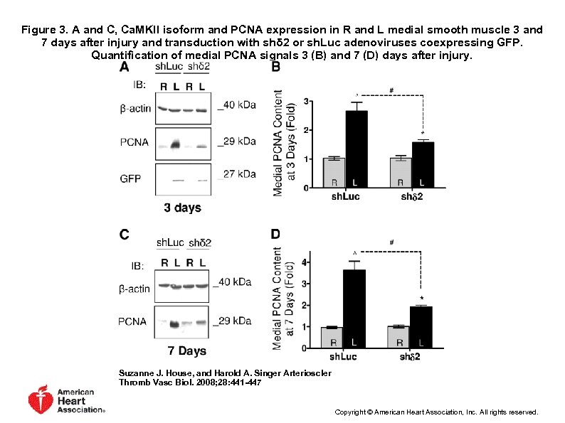 Figure 3. A and C, Ca. MKII isoform and PCNA expression in R and