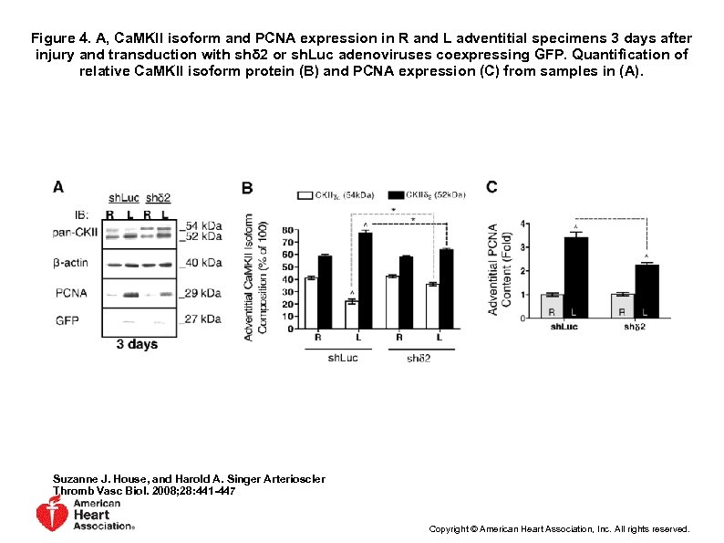 Figure 4. A, Ca. MKII isoform and PCNA expression in R and L adventitial
