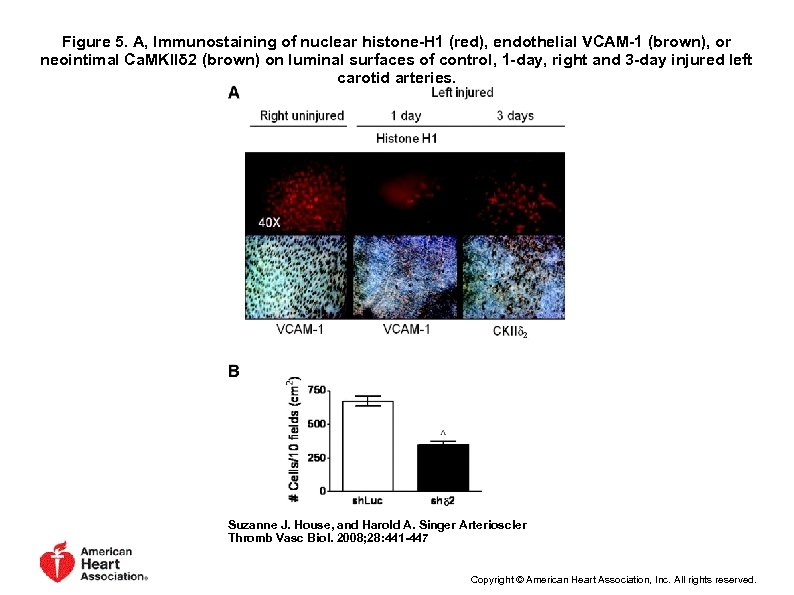 Figure 5. A, Immunostaining of nuclear histone-H 1 (red), endothelial VCAM-1 (brown), or neointimal