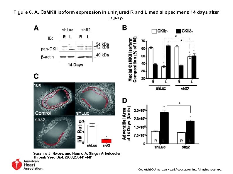 Figure 6. A, Ca. MKII isoform expression in uninjured R and L medial specimens