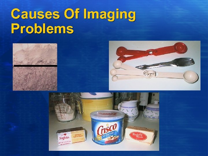 Causes Of Imaging Problems 