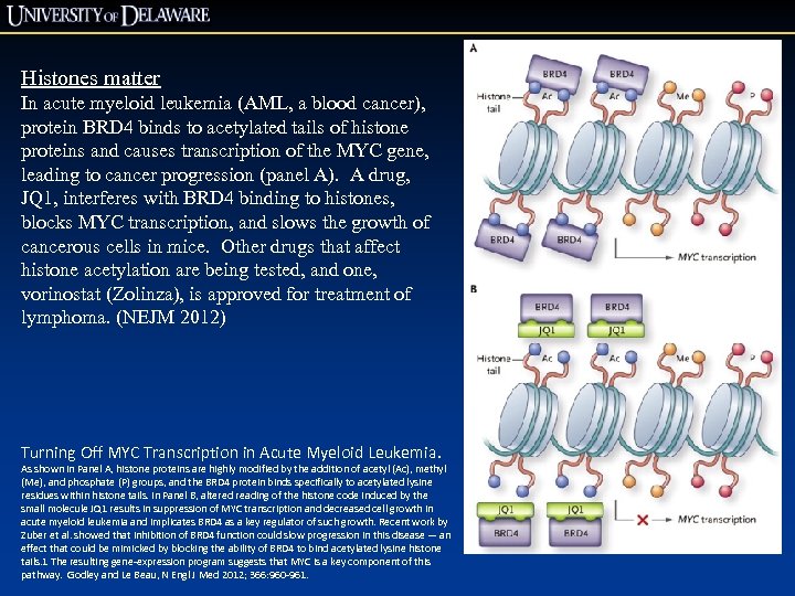 Histones matter In acute myeloid leukemia (AML, a blood cancer), protein BRD 4 binds