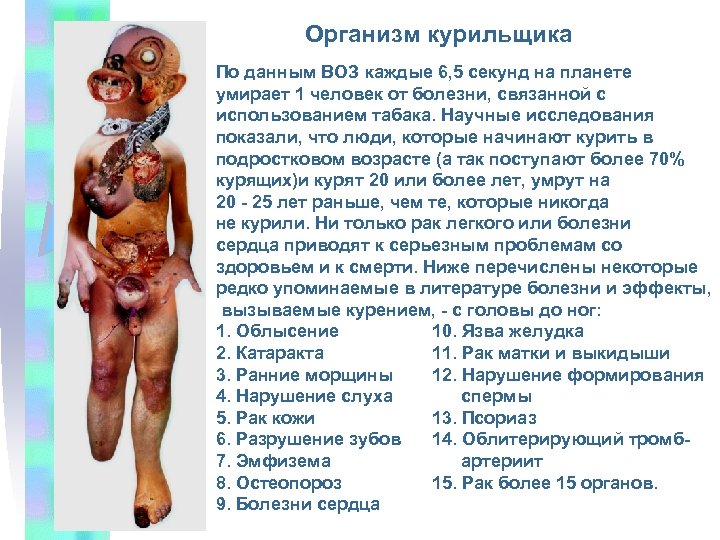 Организм курильщика По данным ВОЗ каждые 6, 5 секунд на планете умирает 1 человек