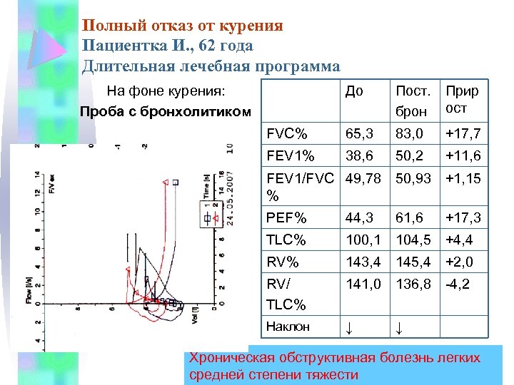 Полный отказ от курения Пациентка И. , 62 года Длительная лечебная программа До Пост.