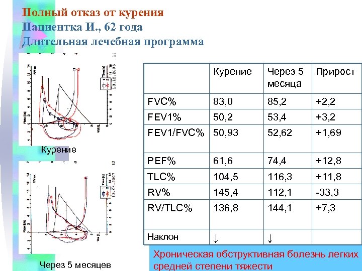 Полный отказ от курения Пациентка И. , 62 года Длительная лечебная программа Курение Через