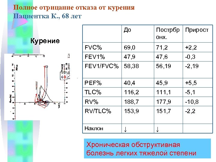 Полное отрицание отказа от курения Пациентка К. , 68 лет До Курение Пострбр Прирост