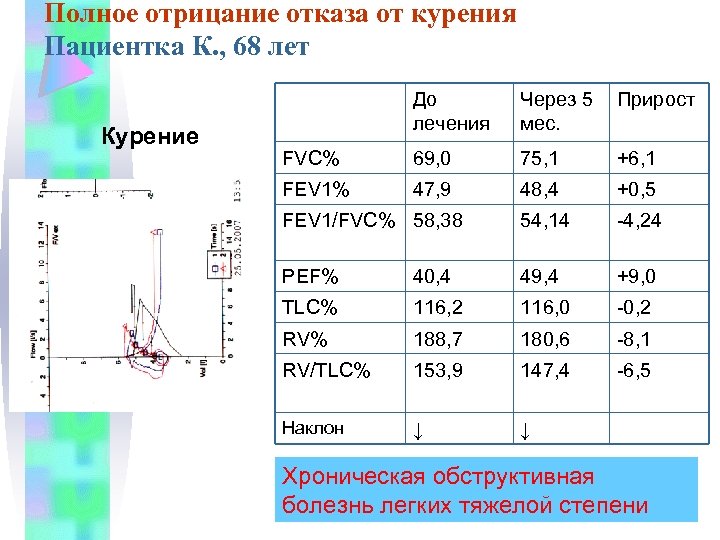 Полное отрицание отказа от курения Пациентка К. , 68 лет Курение До лечения Через