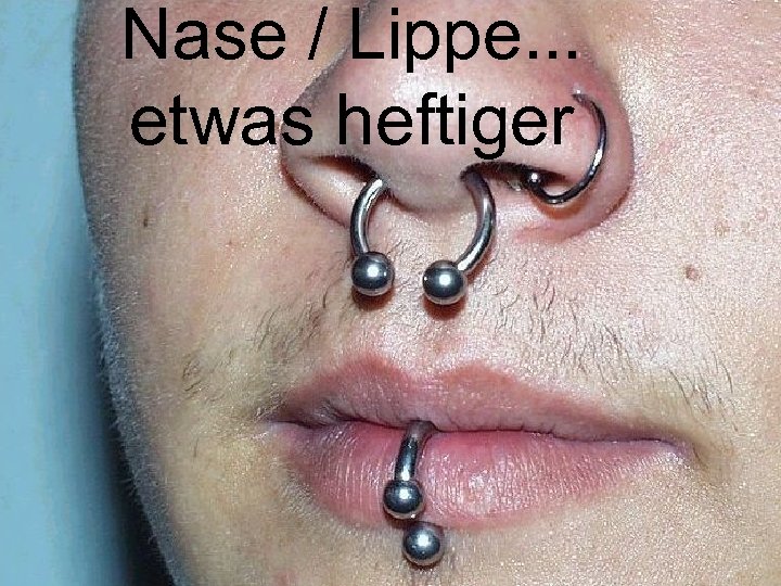 Nase / Lippe. . . etwas heftiger 