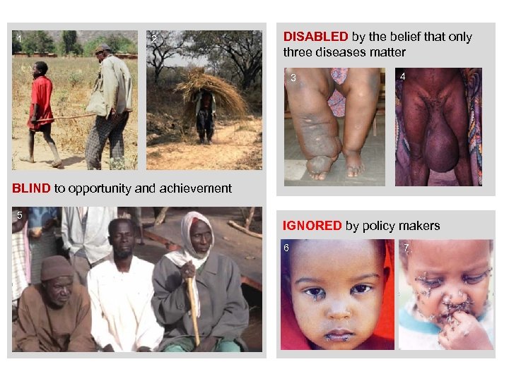 1 2 DISABLED by the belief that only three diseases matter 3 4 BLIND