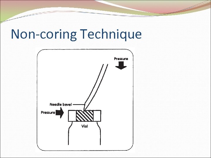 Non-coring Technique 