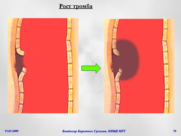 Рост тромба 25. 03. 2009 Владимир Борисович Сулимов, НИВЦ МГУ 39 