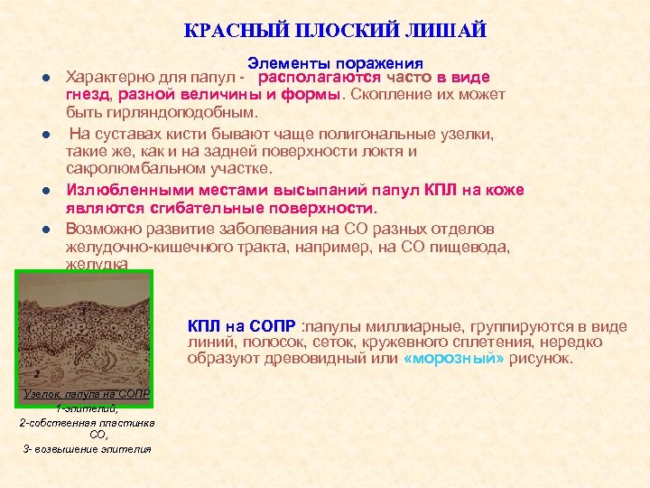 КРАСНЫЙ ПЛОСКИЙ ЛИШАЙ l l Элементы поражения Характерно для папул - располагаются часто в