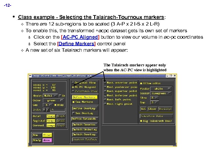 -12 - • Class example - Selecting the Talairach-Tournoux markers: ² ² ² There