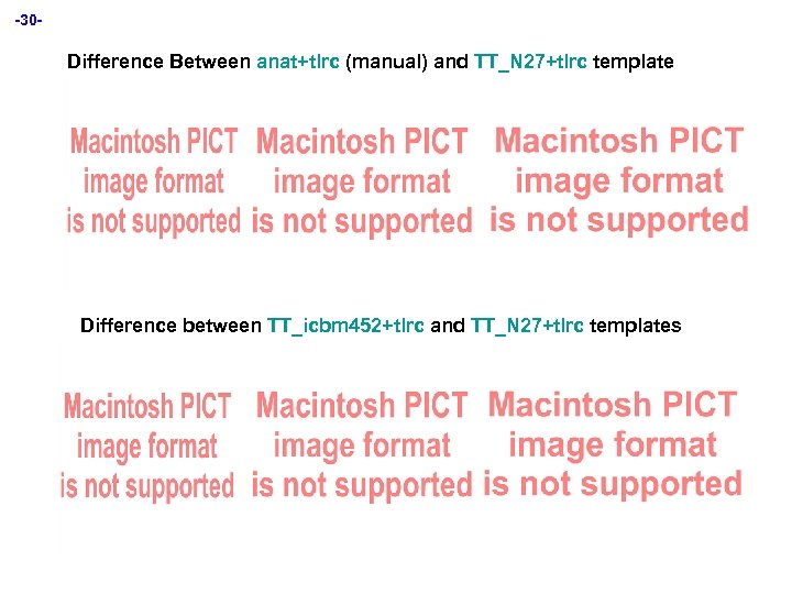 -30 - Difference Between anat+tlrc (manual) and TT_N 27+tlrc template Difference between TT_icbm 452+tlrc