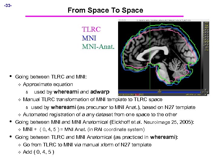 -33 - From Space To Space TLRC MNI-Anat. • Going between TLRC and MNI: