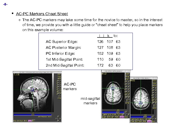 -8 - • AC-PC Markers Cheat Sheet ² The AC-PC markers may take some