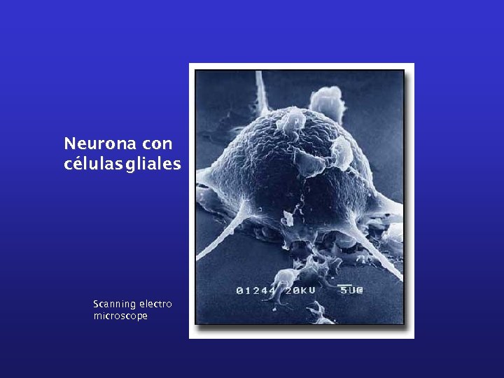 Neurona con células gliales Scanning electro microscope 