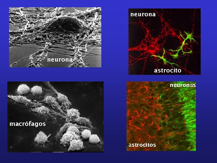 neurona astrocito neuronas macrófagos astrocitos 