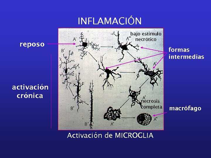 INFLAMACIÓN reposo activación crónica bajo estímulo necrótico formas intermedias necrosis completa Activación de MICROGLIA