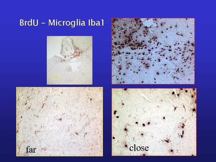 Brd. U – Microglia Iba 1 far close 